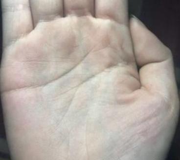 一、 面相层面的二婚指示——山根特征解析