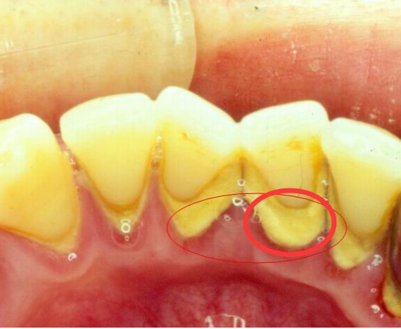 “漏财口”的具体体现