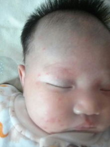 8. 额头中央胎记——智慧领袖与卓越成就