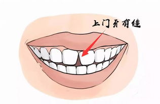 牙齿掉落的乱七八糟象征意义