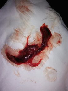 自然流产与风水之间是否存在关联？