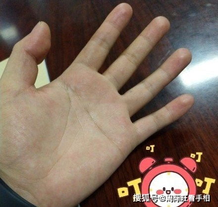 4.2 断掌（横贯手）的社会周边环境评价及其双沉重效应