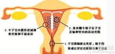 未月经能上环吗？
