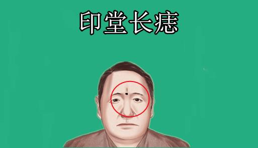 4. 健康运势及医学解释