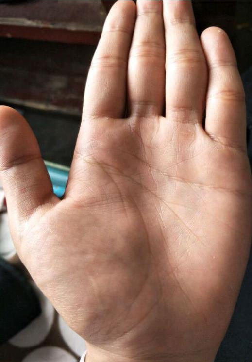 右手中指间隙大是否预示男性命运转折点？