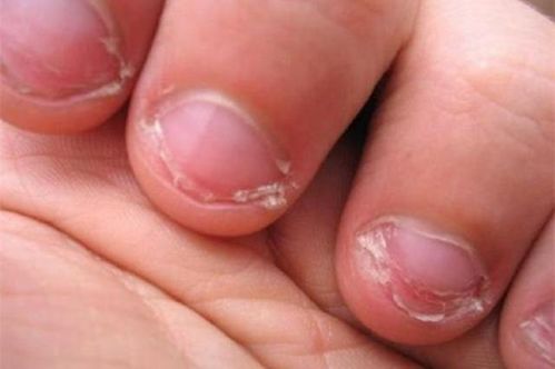 八字中哪些组合容易导致皮肤病？