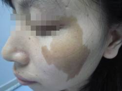 胎记是天赐之吉祥抑或预示不幸——基于传统相学的系统性阐释与批判性分析