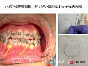 五、其他注意事项