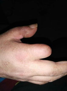 女性二拇指比大拇指长，这究竟意味着什么？