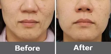 三、  护肤品的选择与使用：日常防御的屏障