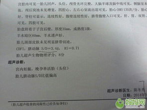 日期差异性所引发的数据校正问题