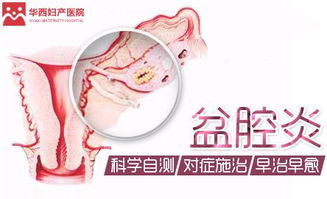 盆腔炎的典型症状和表现