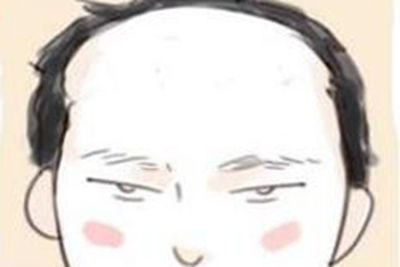 四、印堂狭窄