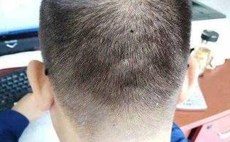 喉结部位：雄性魅力的双刃剑与情感困境的隐喻