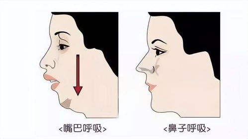 嘴巴干裂是否会对家居风水产生不良影响？