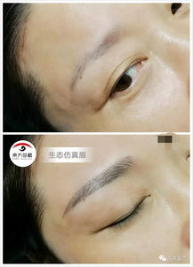 2.1 新陈代谢与色素沉淀：生理机制的解释