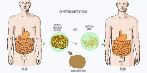 梦见自己大便后手沾满粪便，这究竟是什么预兆或暗示？