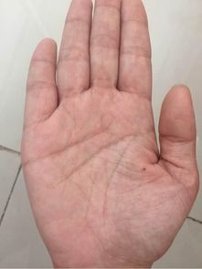 平行于命的特殊形态及其风险