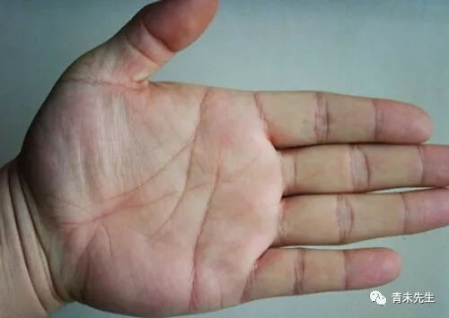 水星丘与无名指的关系