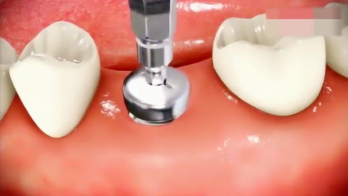 宝瓶口开凿过程3D动画是怎样的？