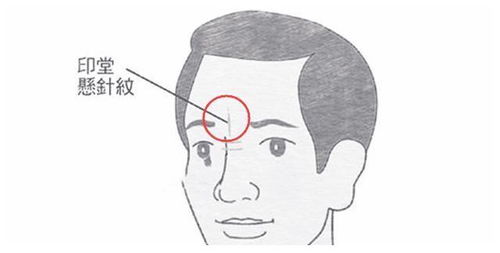 第一章：悬针纹的成因解析与面相学寓意