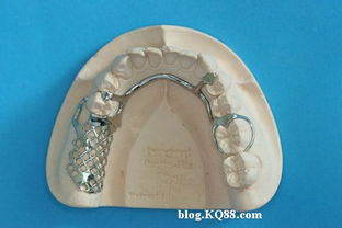 （一）金属性——牙齿