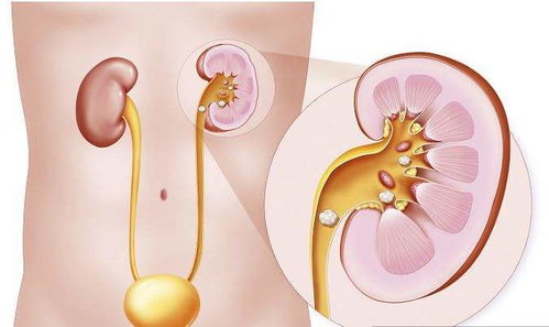 二、 胃肠道疾病：消化功嫩受损下的甜蜜负担