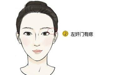 案例一：李先生与掌心痣之象征性作用于
