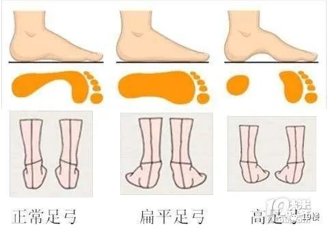 3.1 平坦足底的结构特征及心理映射