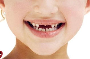 为什么我Zuo梦会感觉上下牙者阝掉了？