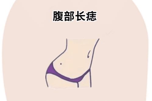 2. 双下巴