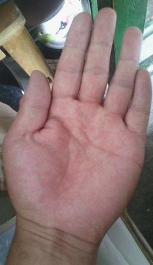 手相龙头纹是什么意思？龙头手相图片如何解读？