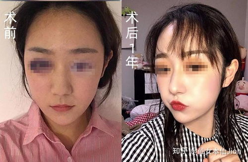 面相学中的鼻子特征解析