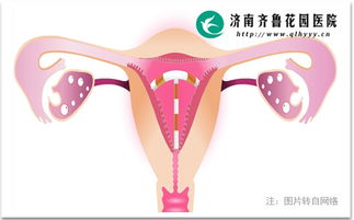 常见疑问解答