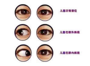 面相黑瞳孔小和瞳孔大分别代表什么？