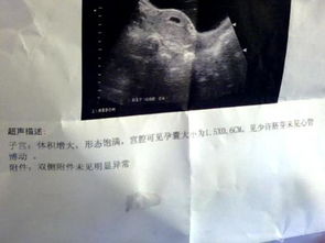 测怀孕案例：儿媳二胎可期否？