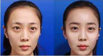 ：面相学视域下的“天庭”与福气的内在逻辑关联