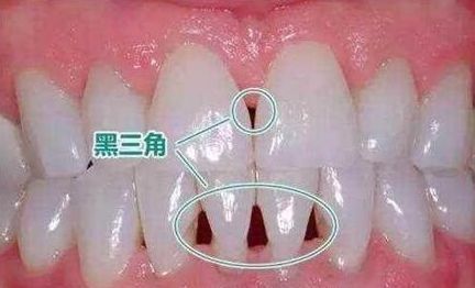 ：口腔健康危机的临床个案与反思