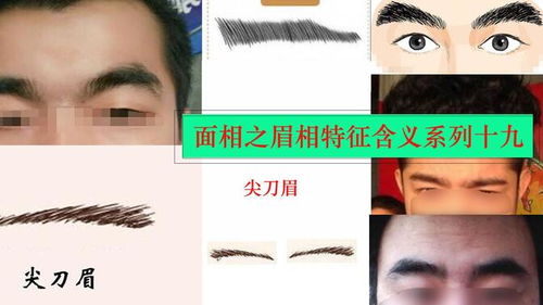 眉头有胎记：富贵双全