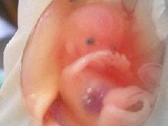 堕胎灵婴缠身之因果机制与深层解析