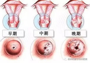 三、别忽视的伴随症状