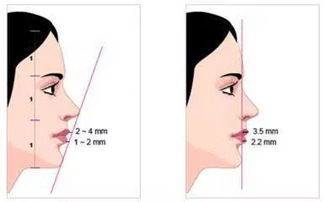 第二章：骨骼形态与审美范式的博弈：月牙型侧颜的深度剖析