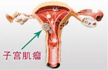 一、 富含雌激素样活性物质的食物及其禁忌