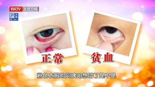 1. 生理状况性性变化波动的局限性