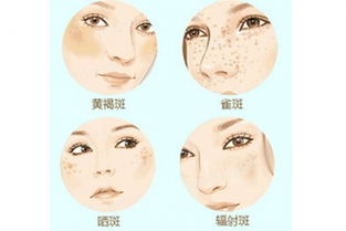 额头长痘痘会对家宅风水产生怎样的影响？