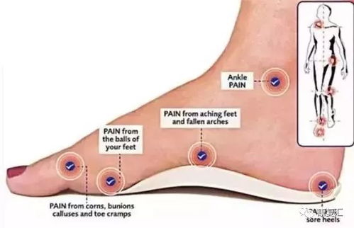 足部畸形矫正——从内八字脚到外八字脚的早期干预路径