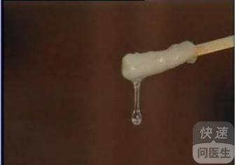 上环与白带异常的关系