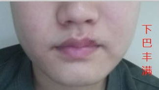 3．上下唇薄而均匀——薄唇型