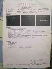 2025年剖腹产和2026年12月顺产分娩的吉日是农历哪一天？