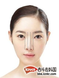 整形与改变：从美学角度看鹰钩鼻